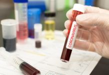 Ochsner to begin in-house testing as health care system faces overload